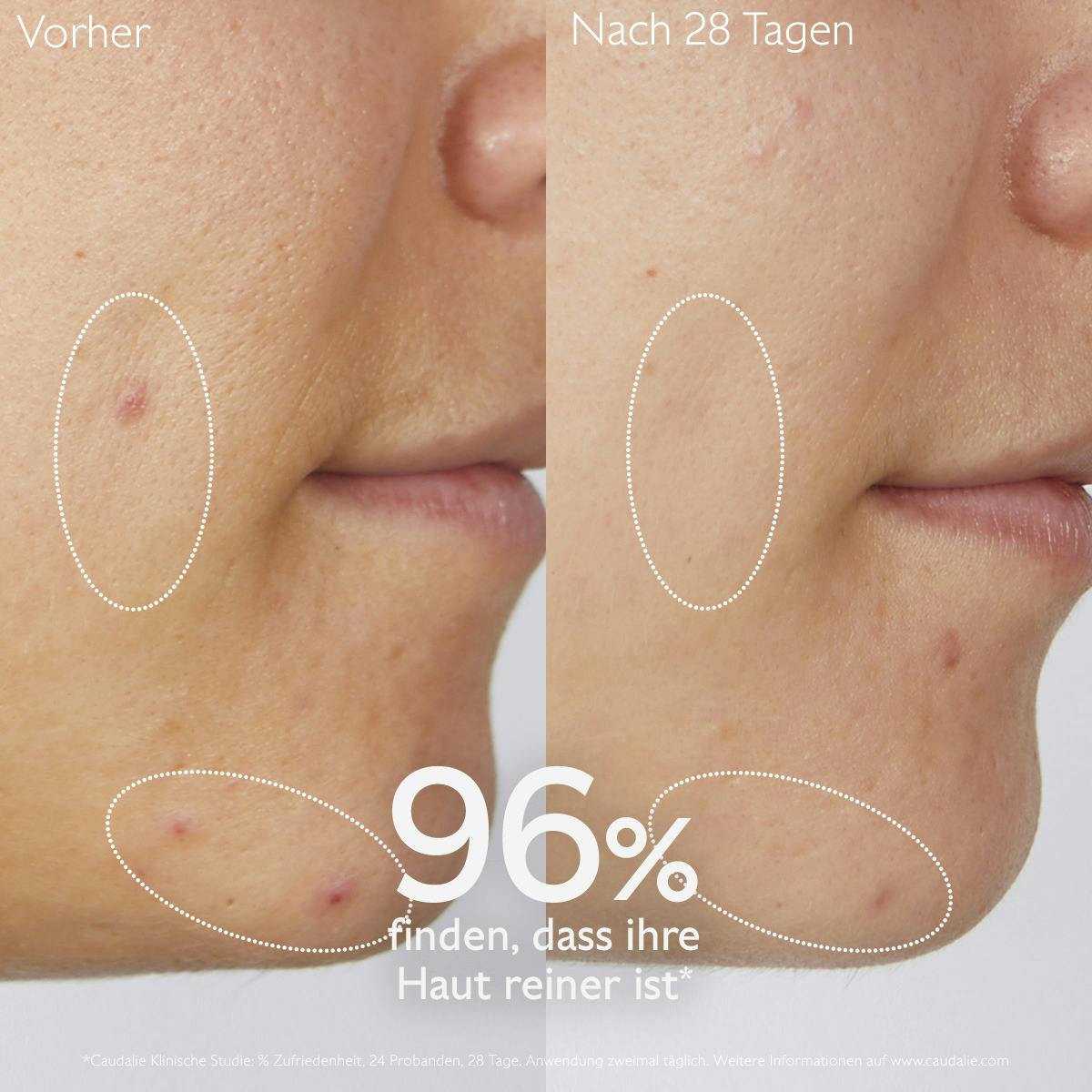 Caudalie - Vinopure Klärendes Reinigungsgel mit Salicylsäure, 75ml
