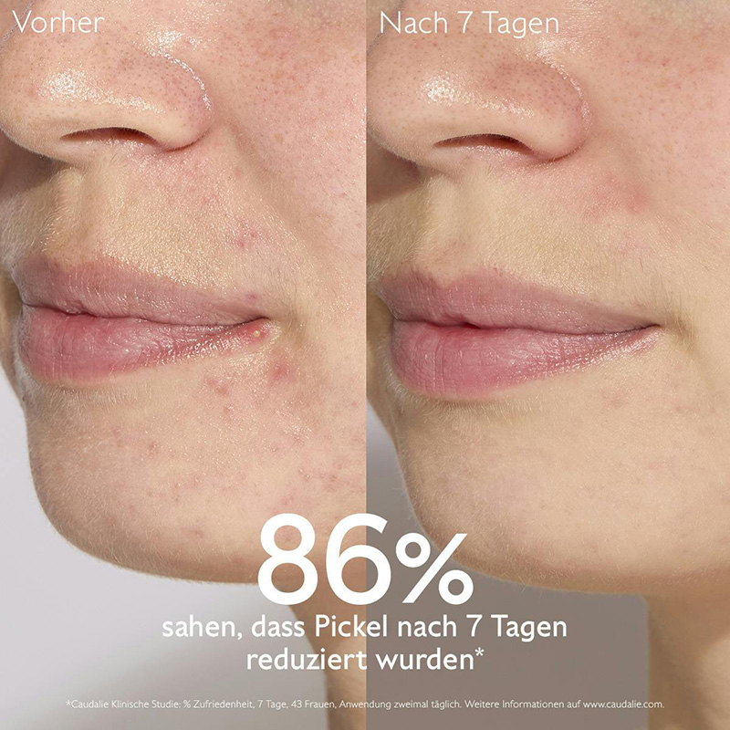 Caudalie - Vinopure Serum mit Salicylsäure, 30ml