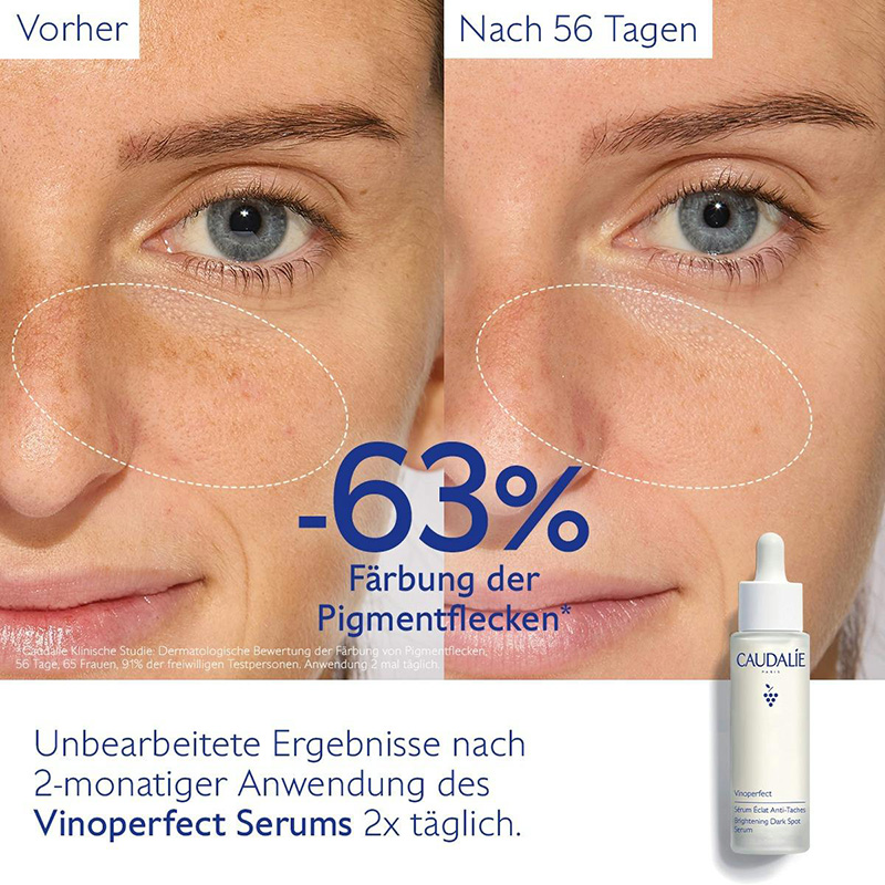 Caudalie - Vinoperfect - Serum gegen Pigmentflecken, 50ml