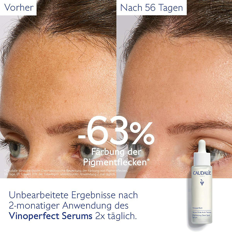 Caudalie - Vinoperfect - Serum gegen Pigmentflecken, 50ml
